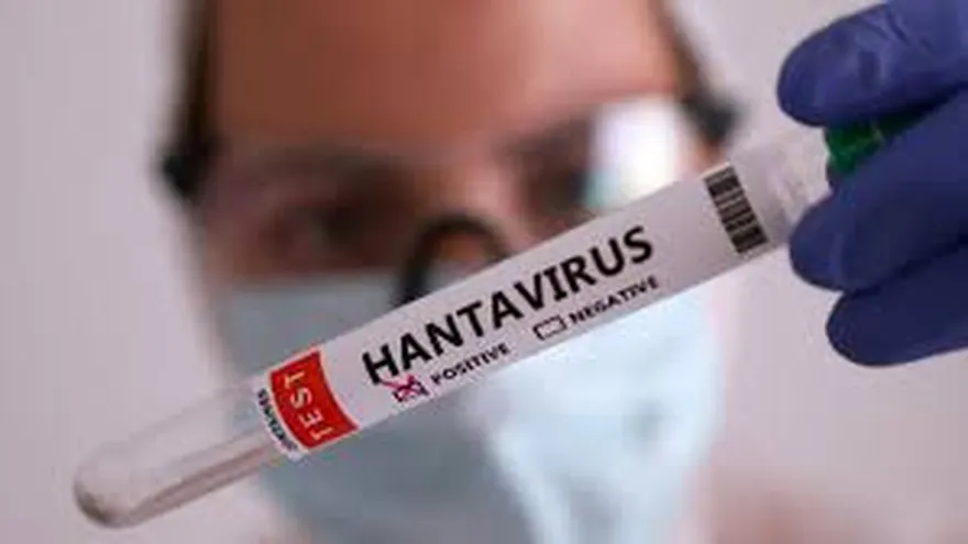 Minsa confirma caso de hantavirus en paciente de 40 años en Guararé